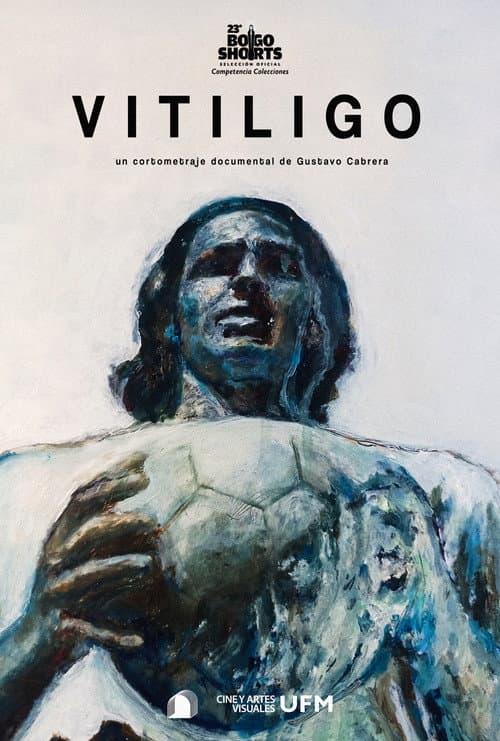 ملصق فيلم Vitiligo (2025)